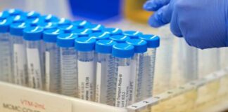 Κορωνοϊός: 33 νέα κρούσματα -Τα 10 στις πύλες εισόδου