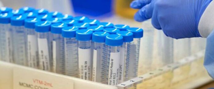 Untitled-1 Κορωνοϊός: 33 νέα κρούσματα -Τα 10 στις πύλες εισόδου