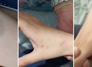 Άρτα: Διευθύντρια σχολείου δάγκωσε 11χρονο μαθητή ΑΜΕΑ Άρτα: Διευθύντρια σχολείου δάγκωσε 11χρονο μαθητή ΑΜΕΑ